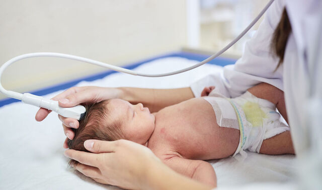 Ein Neugeborenes wird von einer Ärztin untersucht. Es liegt in einer Windel gewickelt da. Von der Ärztin sind nur die Arme und Hände zu sehen.